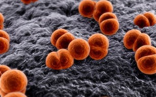 Oroszország - Óvodások betegedtek meg fertőző agyhártyagyulladásban, egy gyerek meghalt