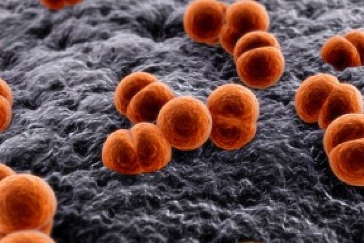 Oroszország - Óvodások betegedtek meg fertőző agyhártyagyulladásban, egy gyerek meghalt